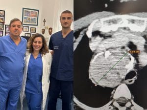 ingrossamento-tiroide-operazione-bari-300x225.jpg