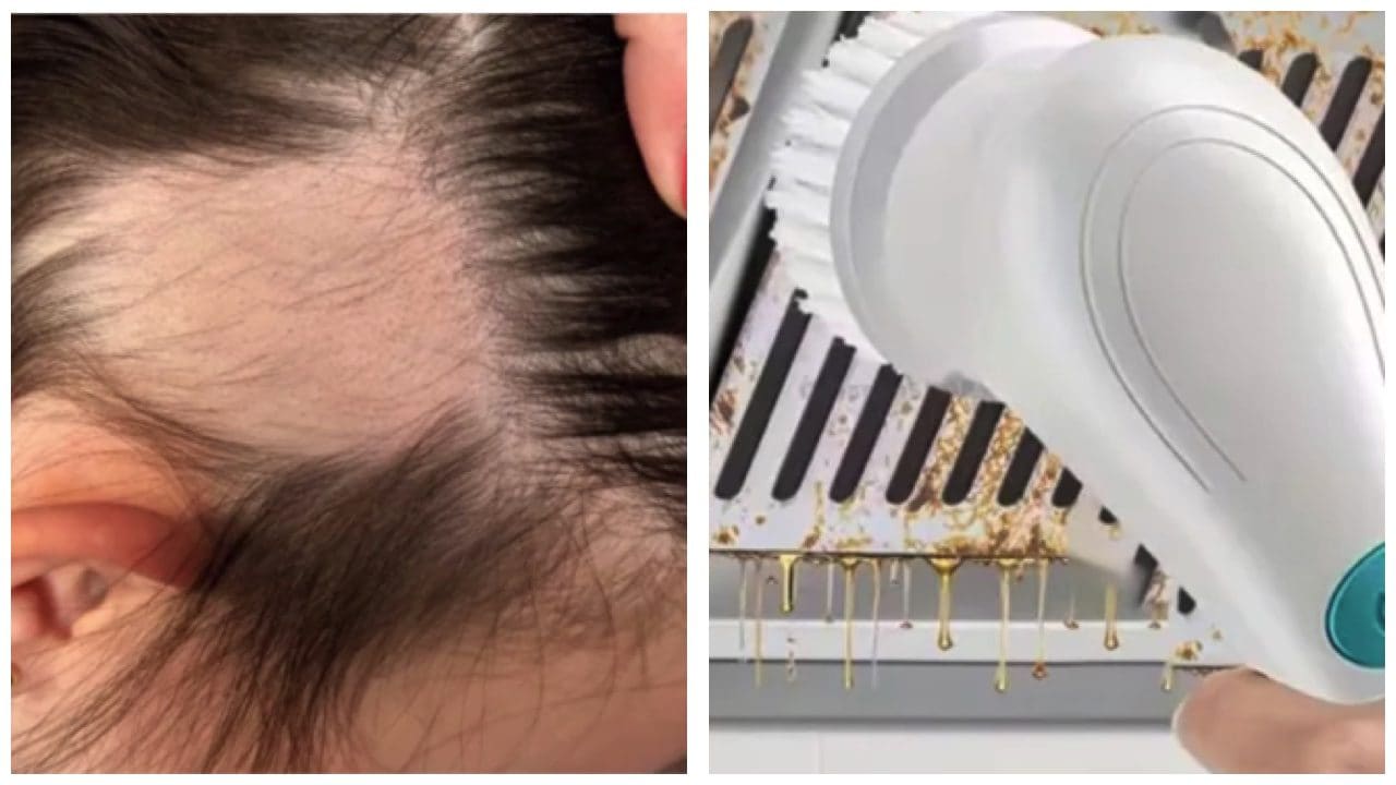 Spazzola rotante comprata su Temu si accende e strappa i capelli alla bimba di 3 anni: allerta in Uk