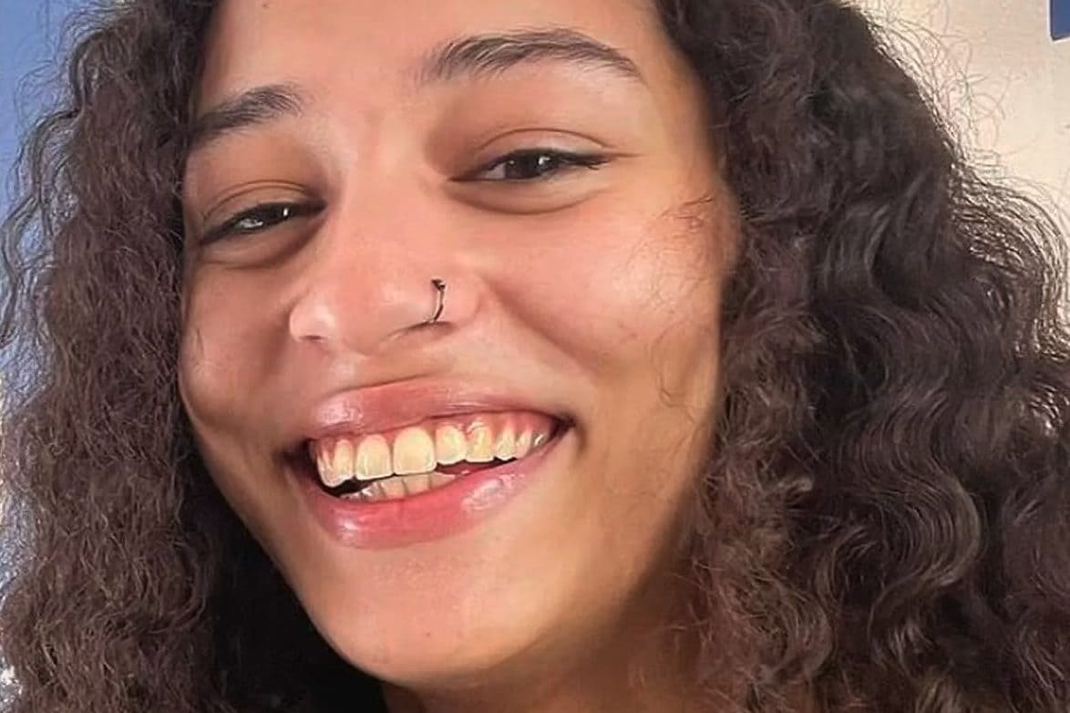 Uccisa da tre pit bull mentre si prendeva cura di loro: così è morta Madison, aveva 23 anni