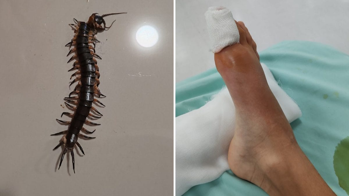 Il morso dell’Asian centipede provoca dolori lancinanti (Foto gentilmente concesse da Salvatore Virdis)