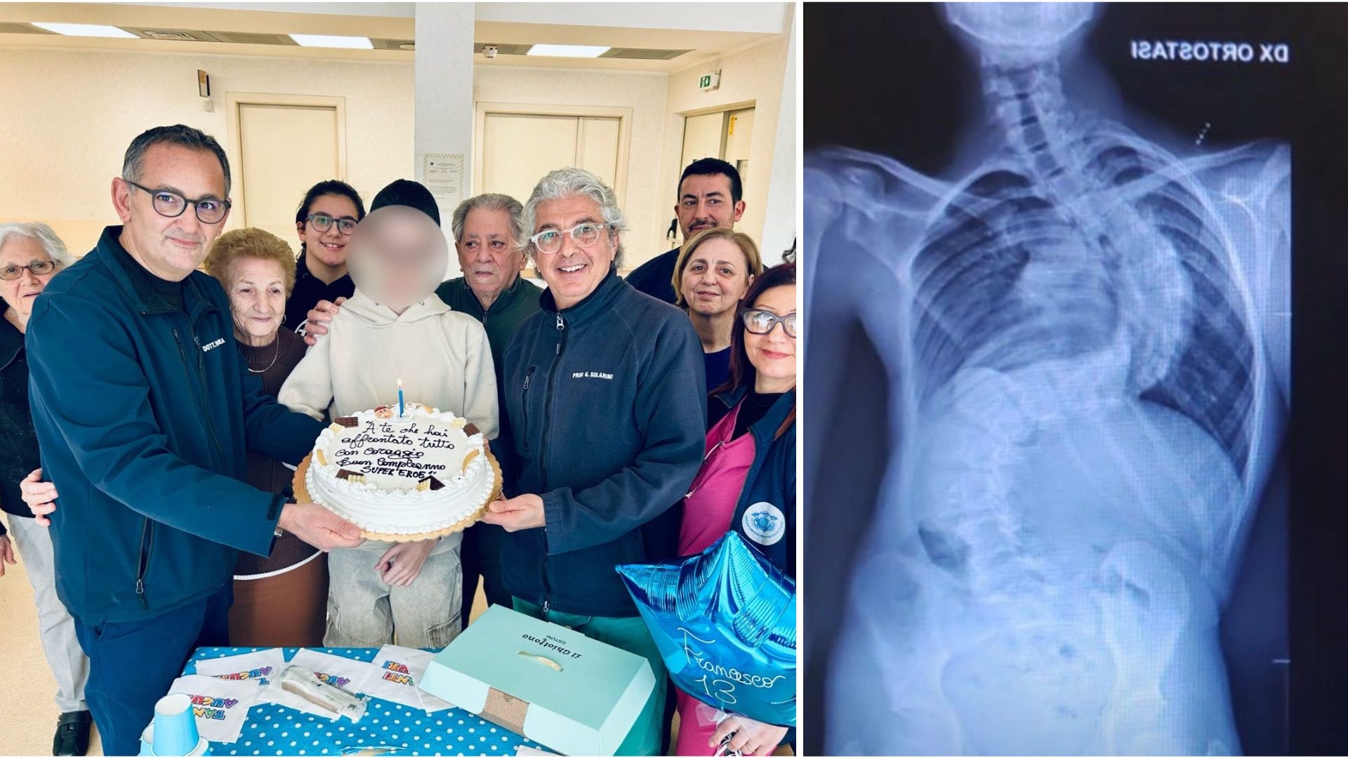 Operato a 13 anni per scoliosi di 117 gradi a Bari. Il chirurgo: “Per Natale in regalo una vita normale”