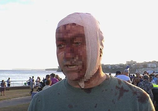 Sopravvissuto al 7 ottobre in Israele, resta ferito durante l’attentato di Bondi Beach: "Caos assoluto"