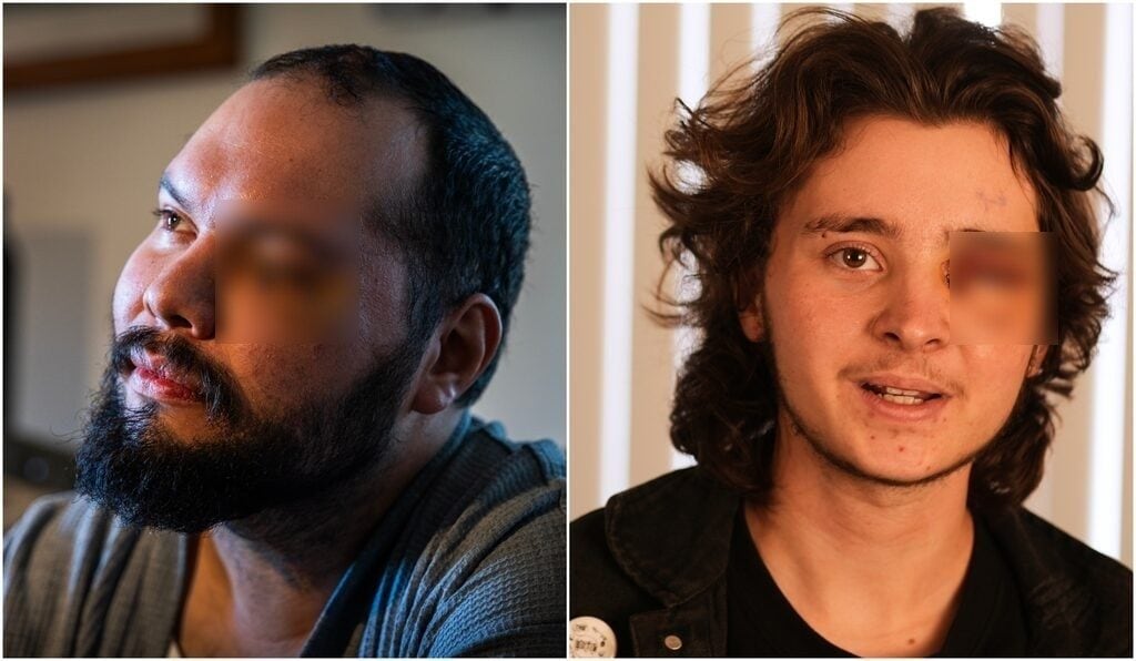 USA, due giovani accecati dagli agenti durante le proteste anti-ICE: "L'occhio mi è esploso nella testa"