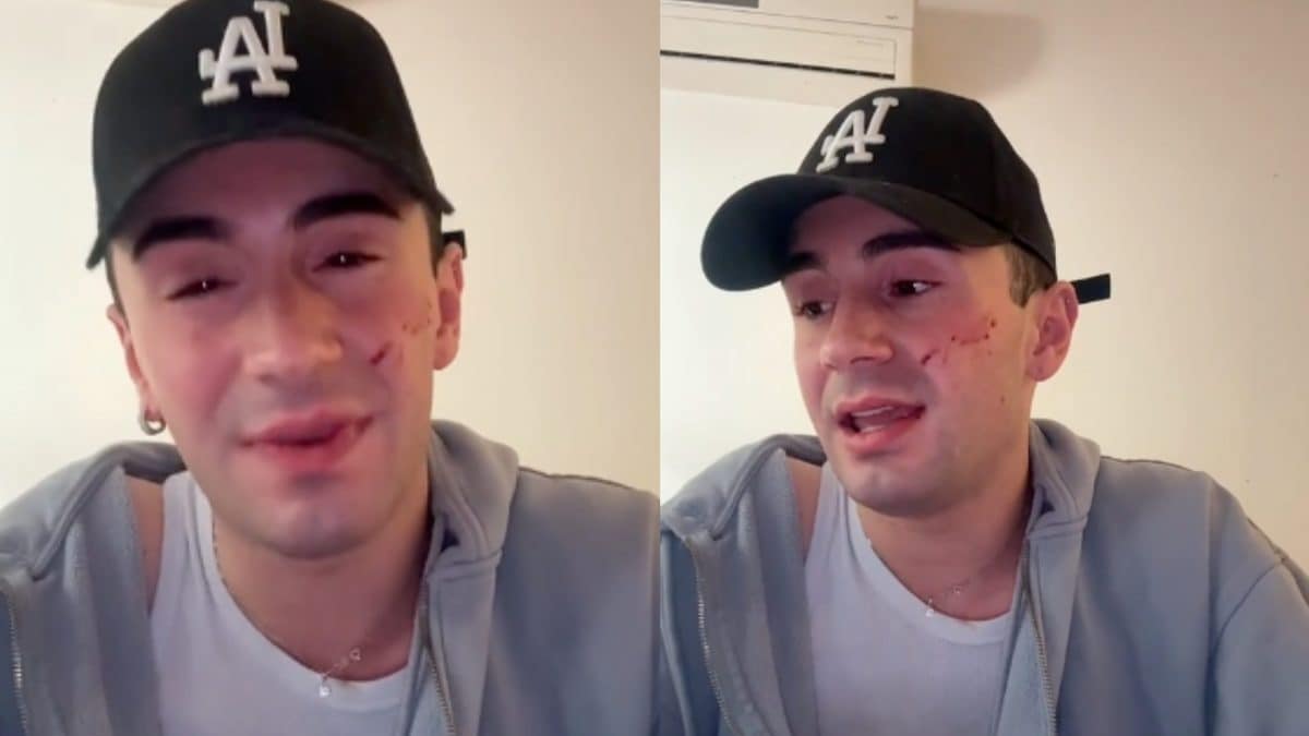 Domenico, 19 anni, aggredito a Genova