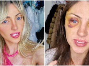 Riesumato il corpo di Barbara Jankavski, l’influencer che voleva diventare una Barbie umana