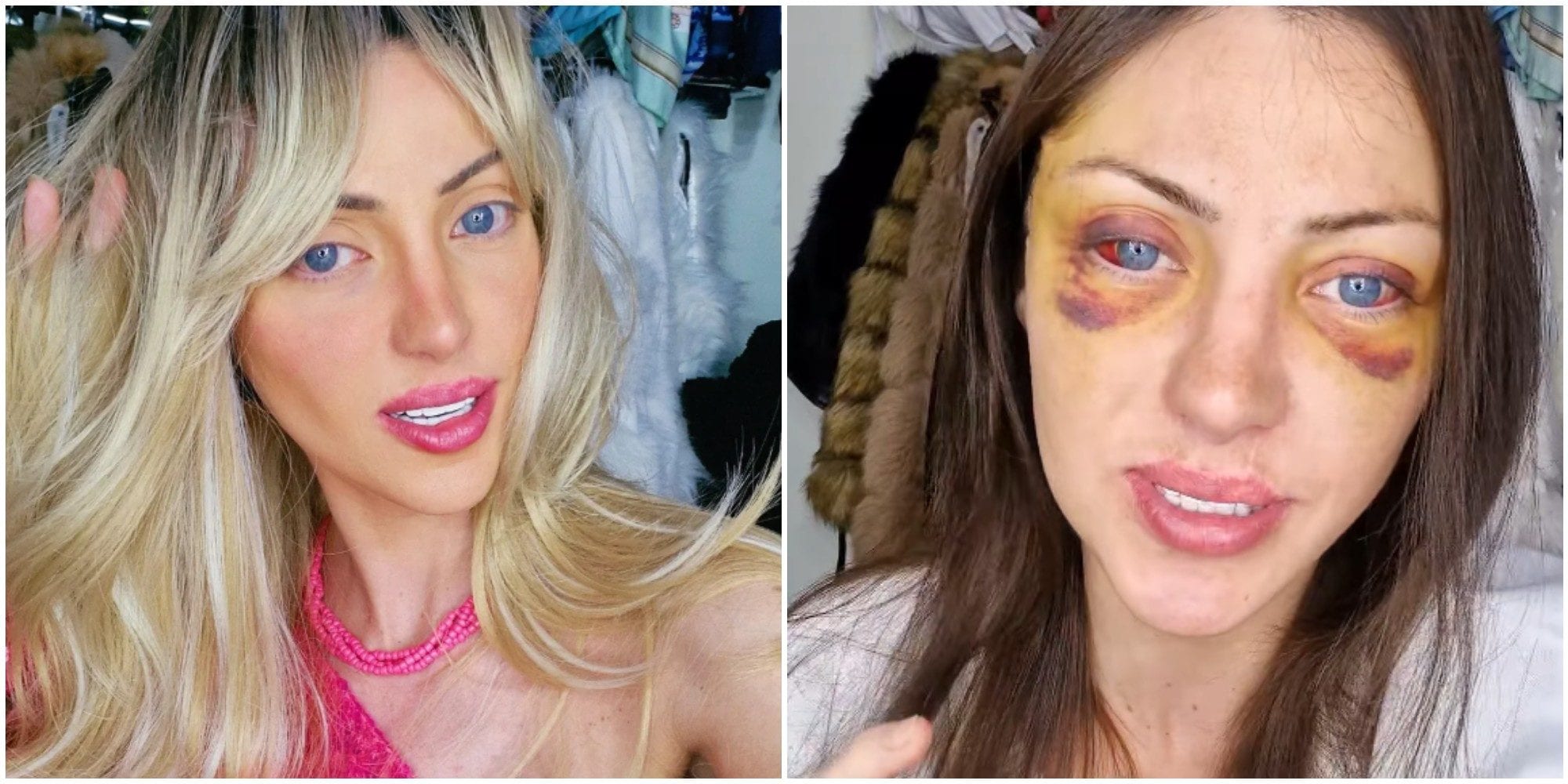 Riesumato il corpo di Barbara Jankavski, l'influencer che voleva diventare una Barbie umana