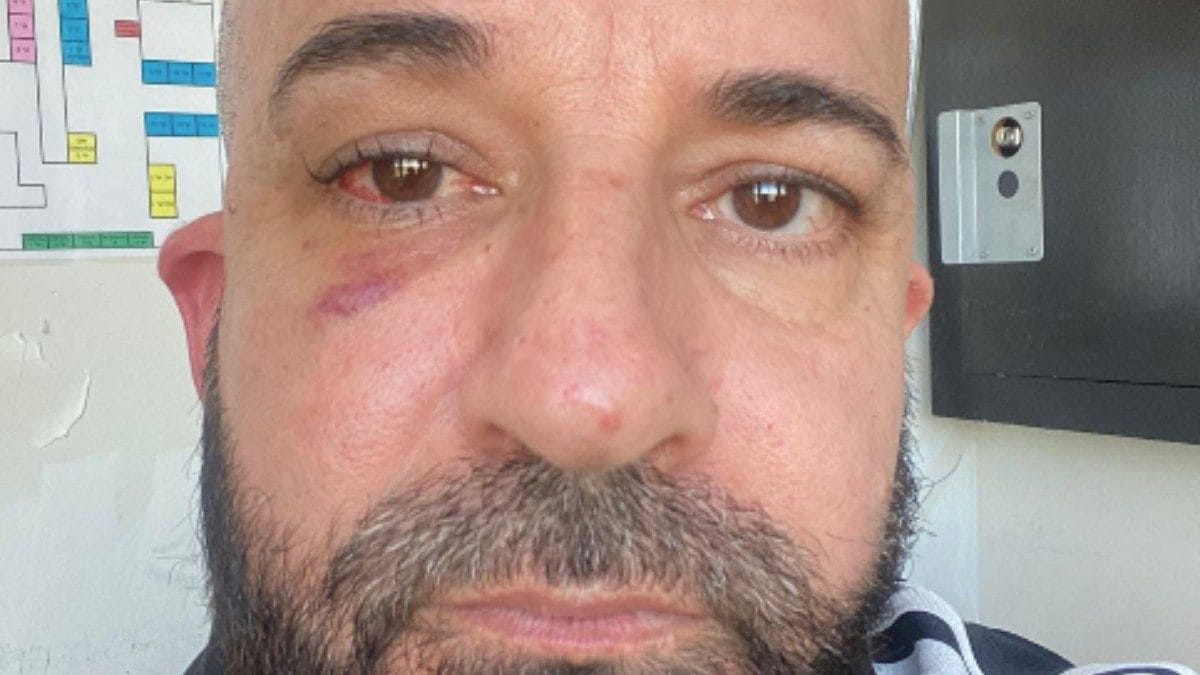 Raffaele Senese due giorni dopo l’aggressione