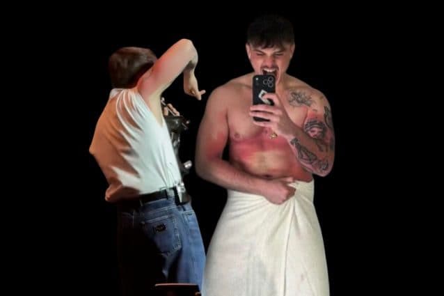 "Sei un cadavere", Olly si ustiona a causa di una lampada abbronzante: la reazione coi fan al concerto