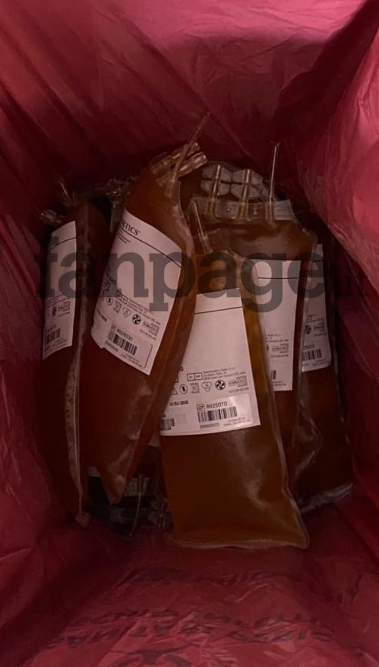 Sacche di plasma gettate in un secchio della spazzatura e destinate allo smaltimento