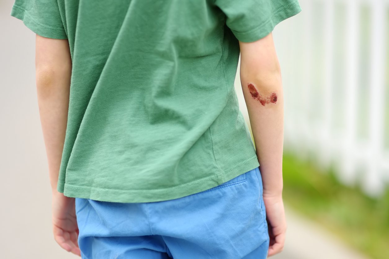 Giarre, 16enne in ospedale dopo l'aggressione di uno sconosciuto, appello della madre: "Aiutatemi a identificarlo"