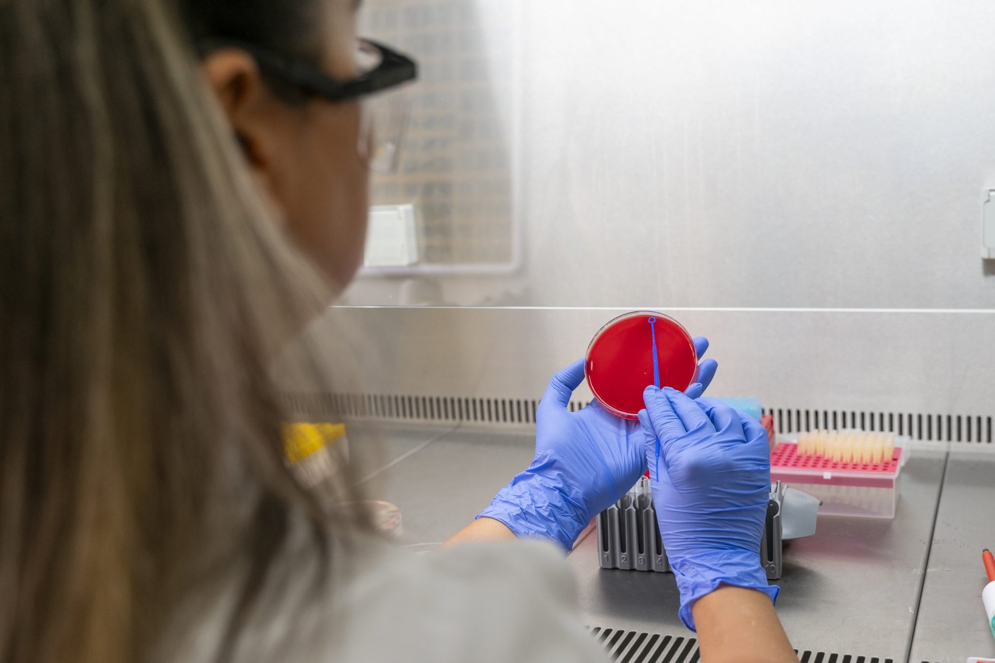 Adolescente a Parma in terapia intensiva per meningite: ha usato l'autobus tutti i giorni, scatta profilassi