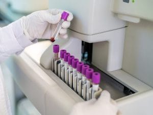 Hantavirus, la circolare del Ministero: “Massima cautela, quarantena di 6 settimane per contatti ad alto rischio”