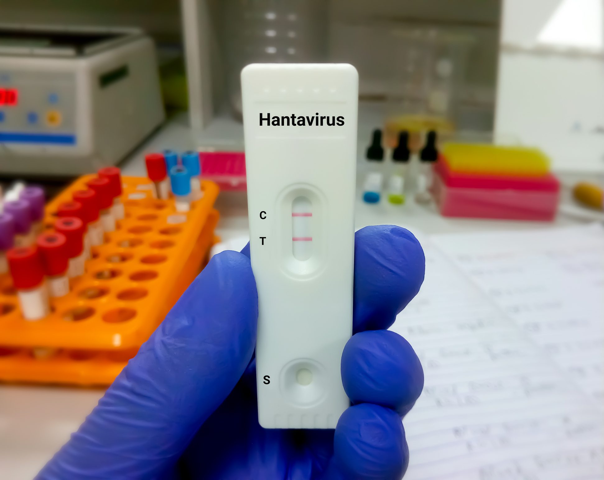 Hantavirus in Italia: quarantena obbligatoria per 2 uomini in Calabria e Campania, donna sotto controllo in Toscana