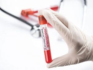 Hantavirus, Ministero della salute: “Negativi tutti i test in Italia. Ecdc: “Nessuna mutazione del virus”, news in diretta