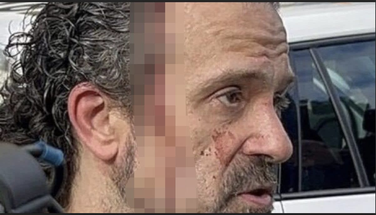 Luca Signorelli, l'eroe di Modena: "Dicevo alla donna con le gambe tranciate di non muoversi, era sveglia"