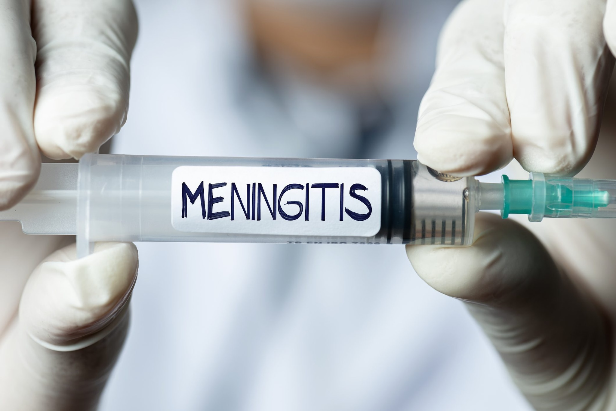 Focolaio di meningite in Inghilterra, uno studente morto e due ricoverati nell'Oxfordshire