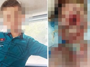 Mohammed sfigurato a 10 anni da una bomba israeliana, l’appello per salvarlo: “Va evacuato da Gaza e curato”