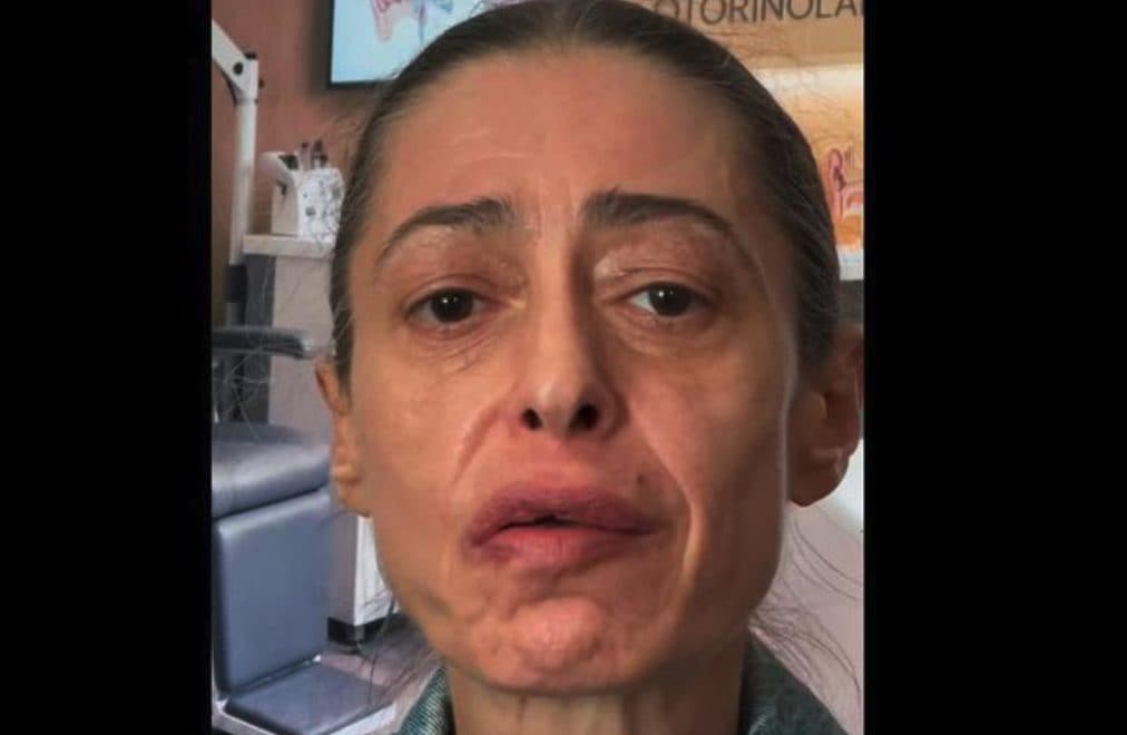 Gerardina Trovato costretta a fermare il tour per problemi di salute: "Dite una preghiera per me"