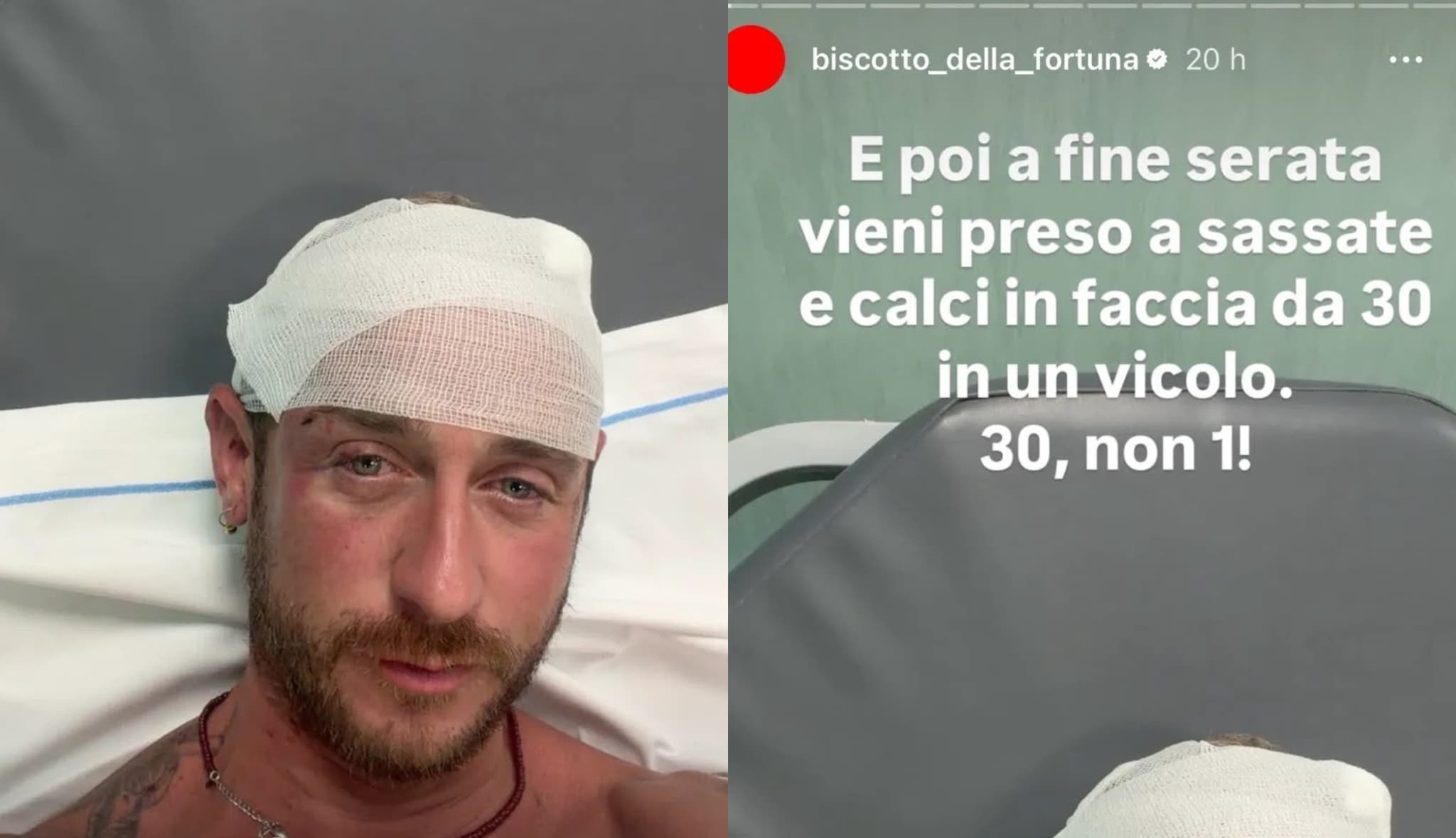 Prima gli insulti e poi il pestaggio, aggressione omofoba a Olbia: "Presi a sassate e calci in faccia"