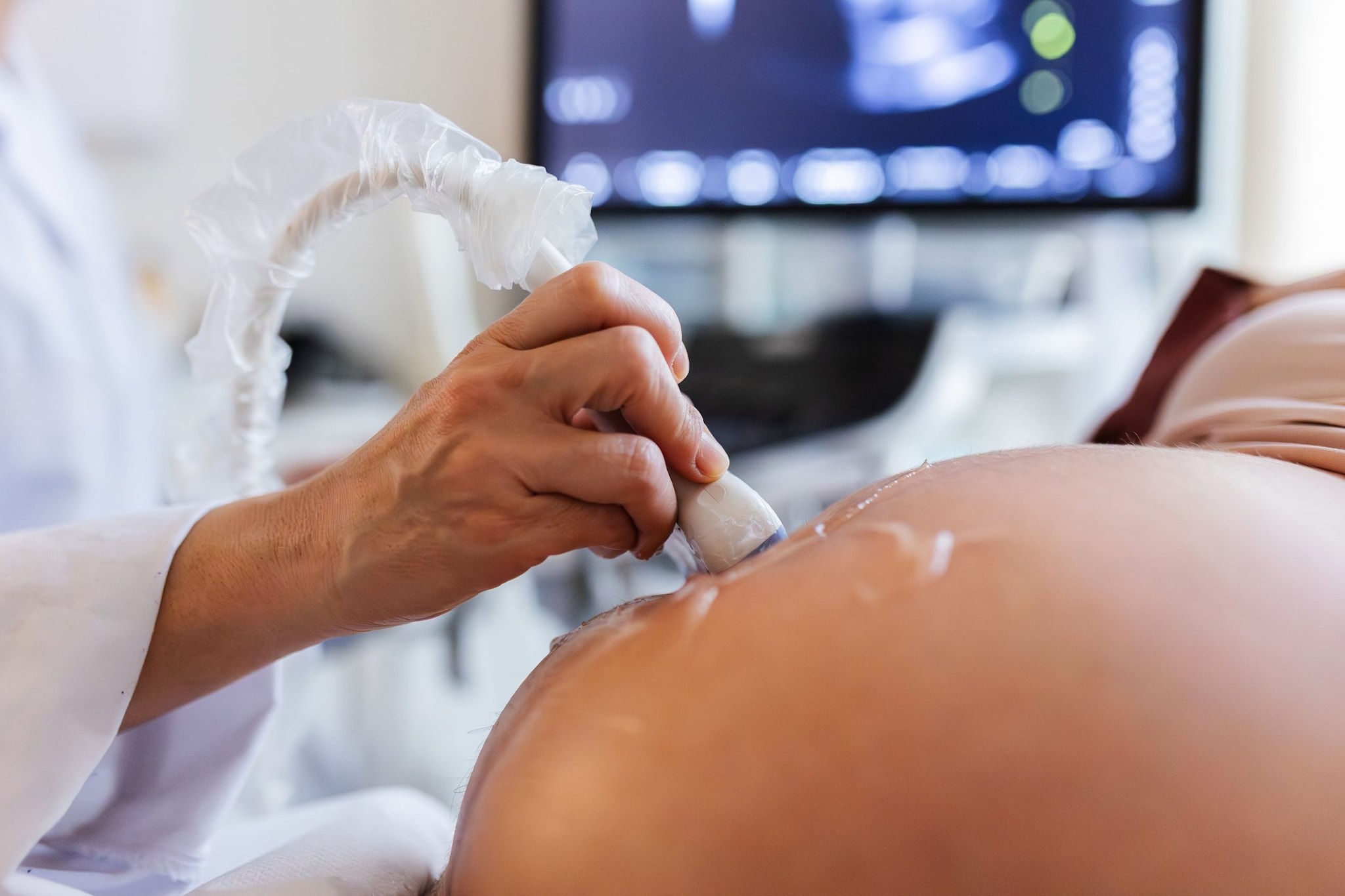 Malformazione fetale non diagnosticata, 644mila euro alla madre che avrebbe potuto scegliere l'aborto