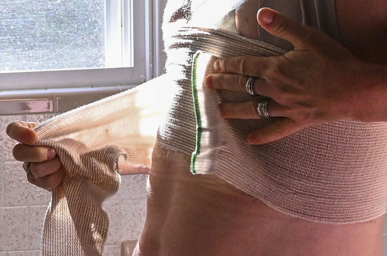 Più di 20 donne sottoposte a mastectomia non necessaria nel Regno Unito