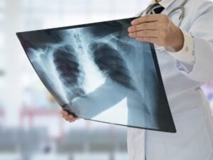 Paziente 69enne muore dopo il trasferimento per la mancanza di radiologi