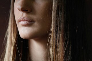 herpes sotto il naso dopo raffreddore