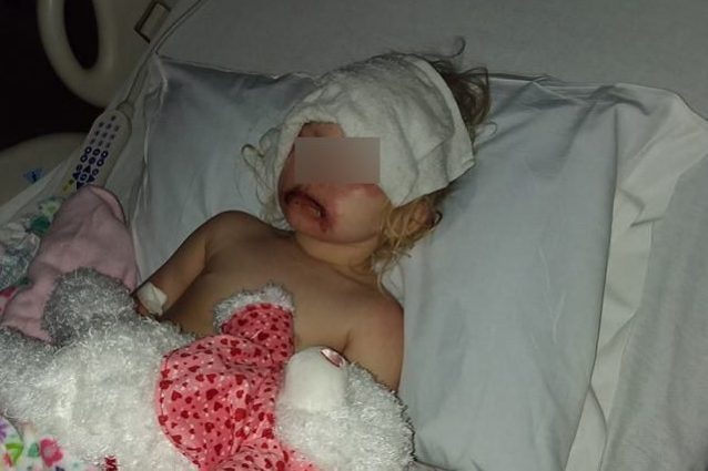 La bimba usa dei trucchi e finisce in ospedale: ha avuto una terribile reazione allergica