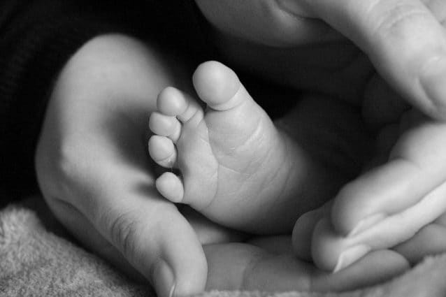 Il bambino nato con due teste, una complicata operazione gli salva la vita