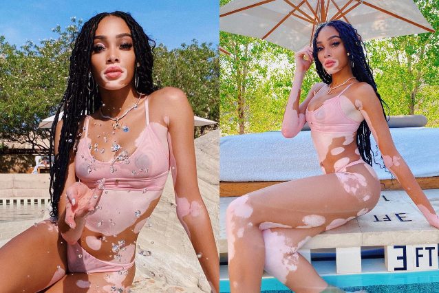 Winnie Harlow col micro bikini: mette in mostra la vitiligine ed è più sexy che mai