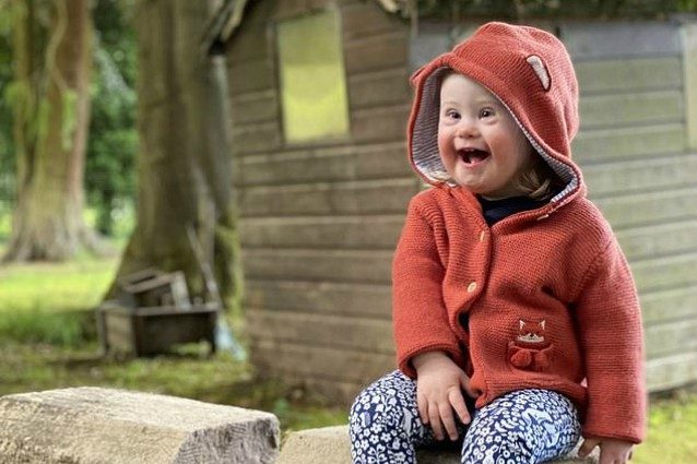 Eleanor, la bambina con la sindrome di Down diventa modella: a 2 anni è simbolo di inclusività