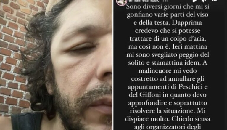 Immagine