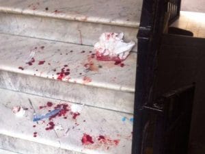 Sangue, violenza domestica (Immagine di repertorio)
