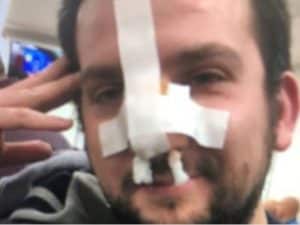 Antonio Atte dopo essere stato medicato in ospedale