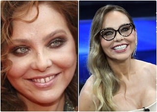 Ornella Muti e il diastema ai denti, le star ricorse alle "faccette" per correggere l'imperfezione