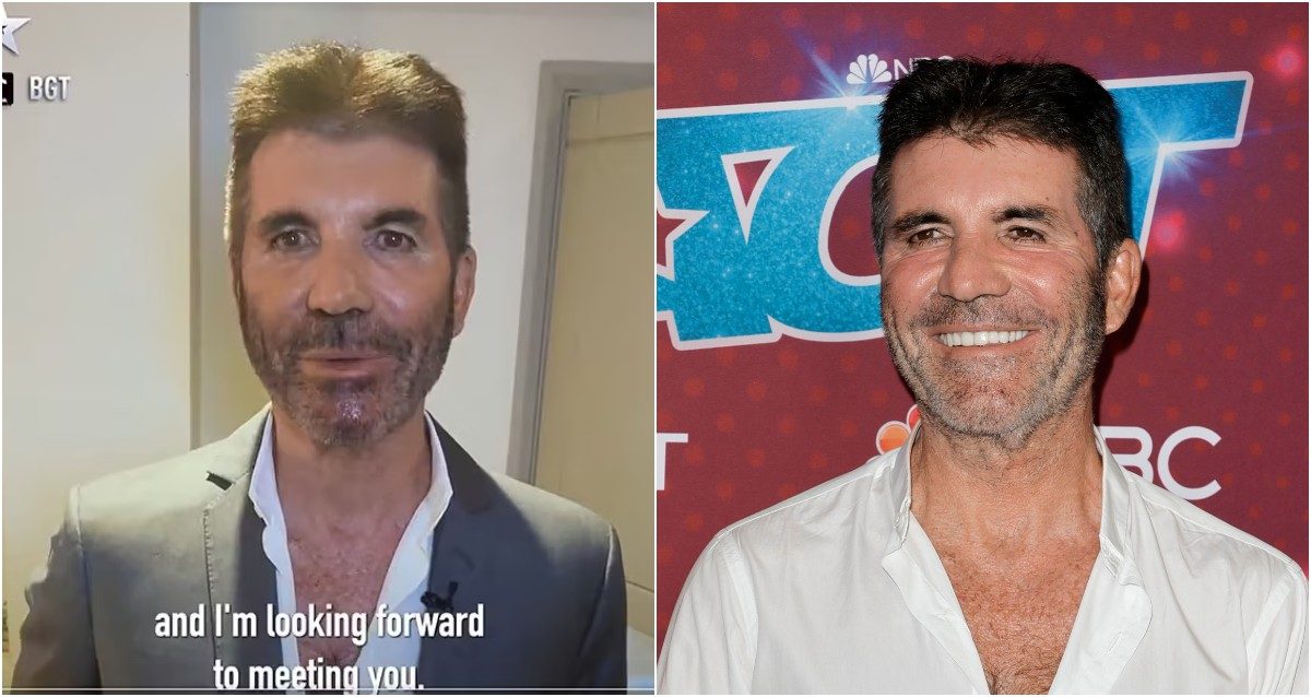 "Cosa ha fatto alla faccia?", Simon Cowell di Britain's Got Talent