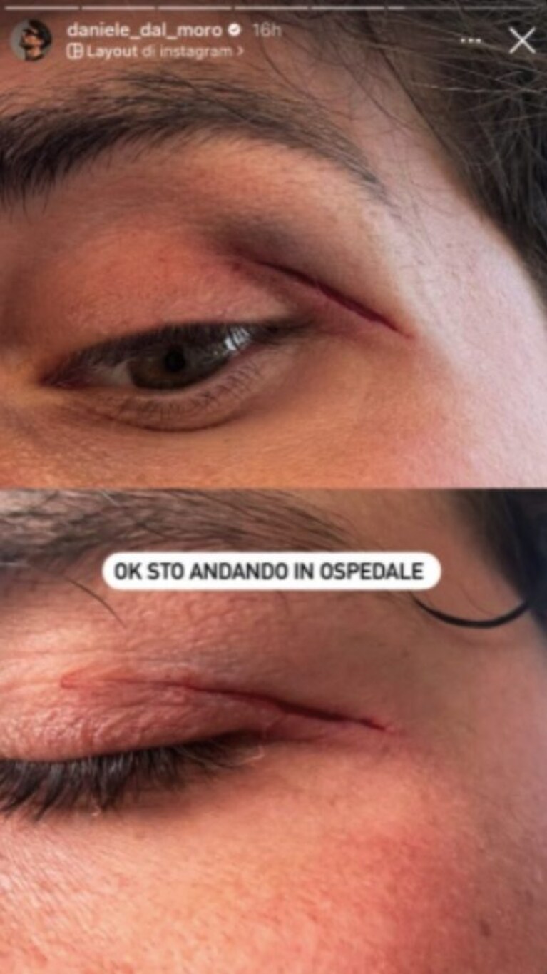Immagine