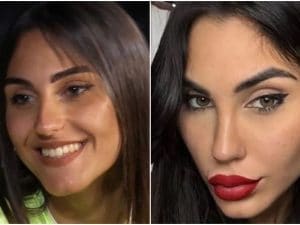 Gabriela Chieffo criticata dopo il filler, la replica furiosa: &#8220;Cattive, frustrate e gelose. Mi vergogno di essere donna come voi&#8221;