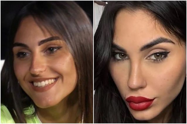 Gabriela Chieffo criticata dopo il filler, la replica furiosa: "Cattive, frustrate e gelose. Mi vergogno di essere donna come voi"