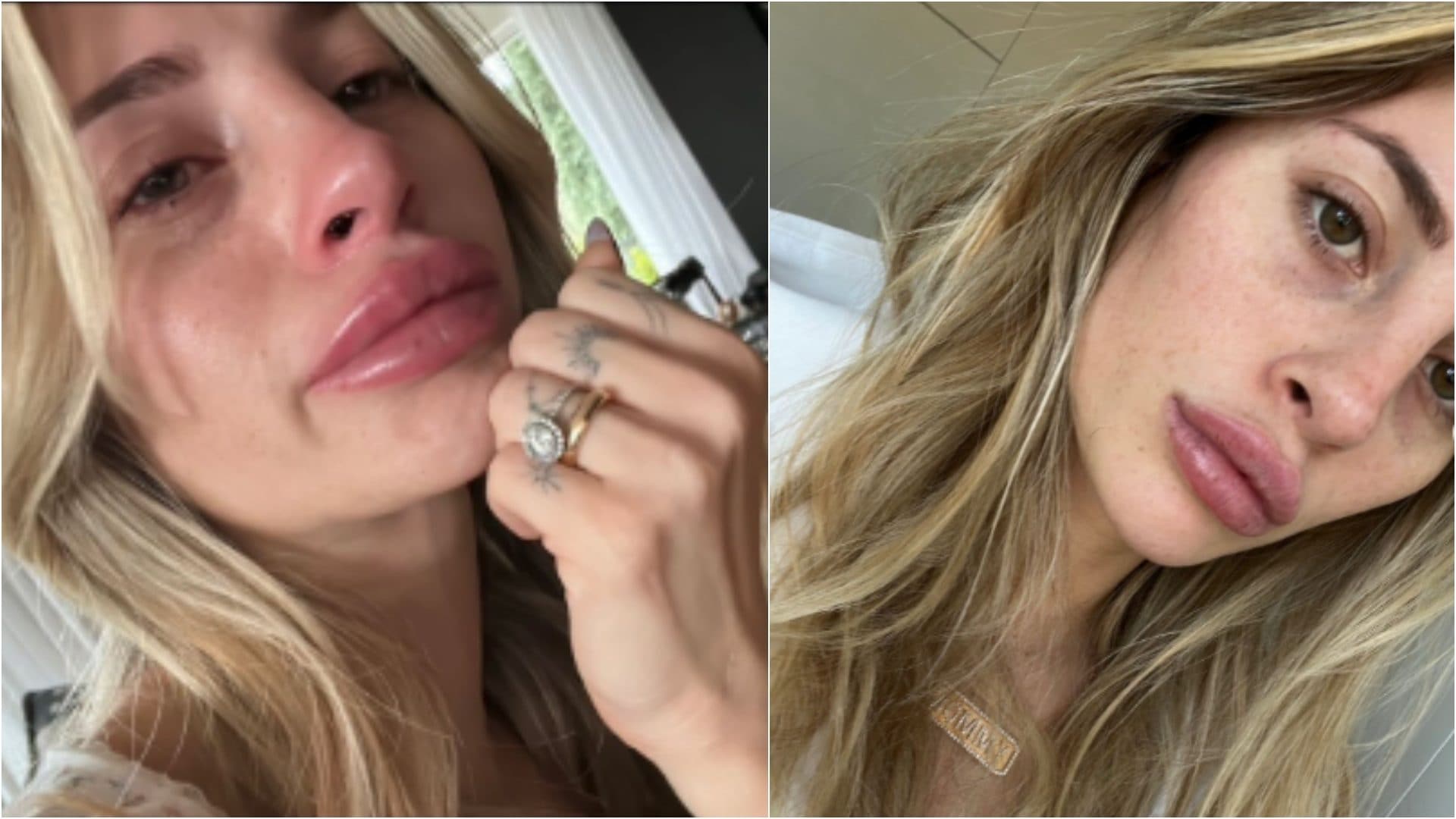 Chiara Nasti: "Ho sofferto di attacchi di panico e preso psicofarmaci. Ero persa, poi ho chiesto aiuto"