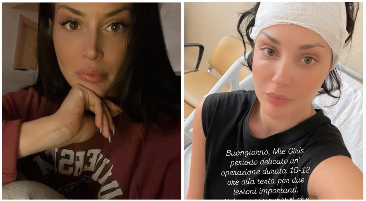 Come sta Diletta Pagliano dopo l'operazione alla testa: "I dottori si stanno prendendo del tempo per capire"