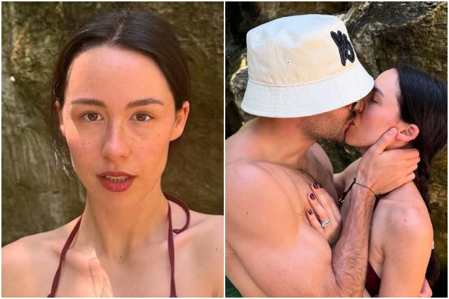 Disavventura per Aurora Ramazzotti: "È stata punta da una medusa, Goffredo Cerza l'ha consolata con un bacio"