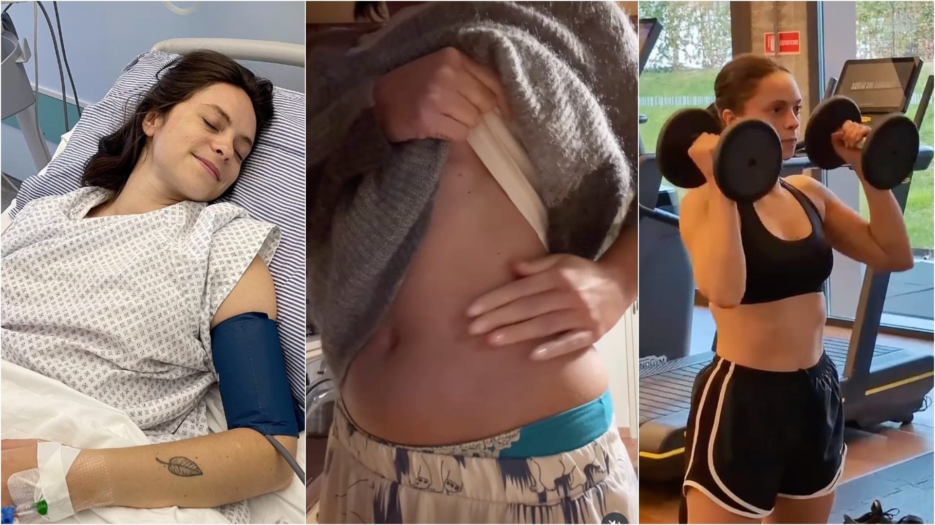 Francesca Michielin a due anni dall'operazione al rene: "Ho attraversato il dolore, sono orgogliosa del mio corpo"