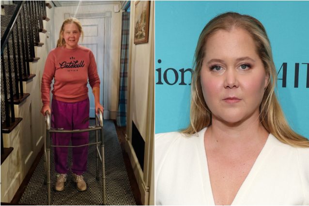 L'attrice Amy Schumer cammina con il deambulatore: operata dopo un incidente mentre faceva surf