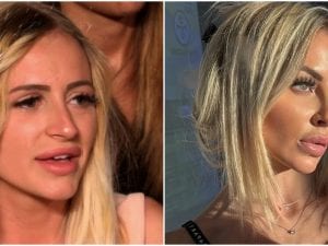 La fotonica Katia Fanelli criticata per i ritocchini estetici replica: “Mi fate tenerezza, ecco cosa ho rifatto”