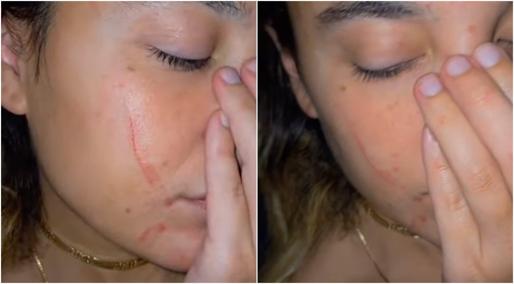 Marilena Sansone, l'influencer aggredita da una vegana: "Solo perché mangio la carne"