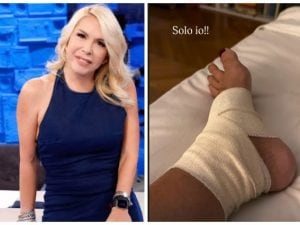 Infortunio per Anna Pettinelli, la foto sui social: &#8220;Solo io mi slogo la caviglia così&#8221;