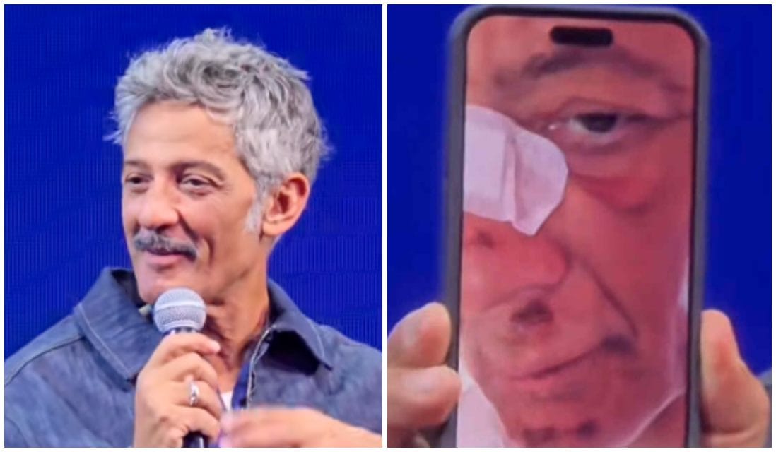 Fiorello racconta il brutto incidente in bici: "Conciato male. Sono volato di faccia, mi hanno soccorso 3 operai"