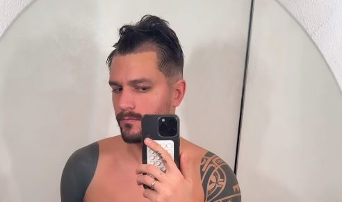 Andrea Zelletta spiega perché ha deciso di sottoporsi al trapianto di capelli: "Mi dava fastidio la stempiatura"