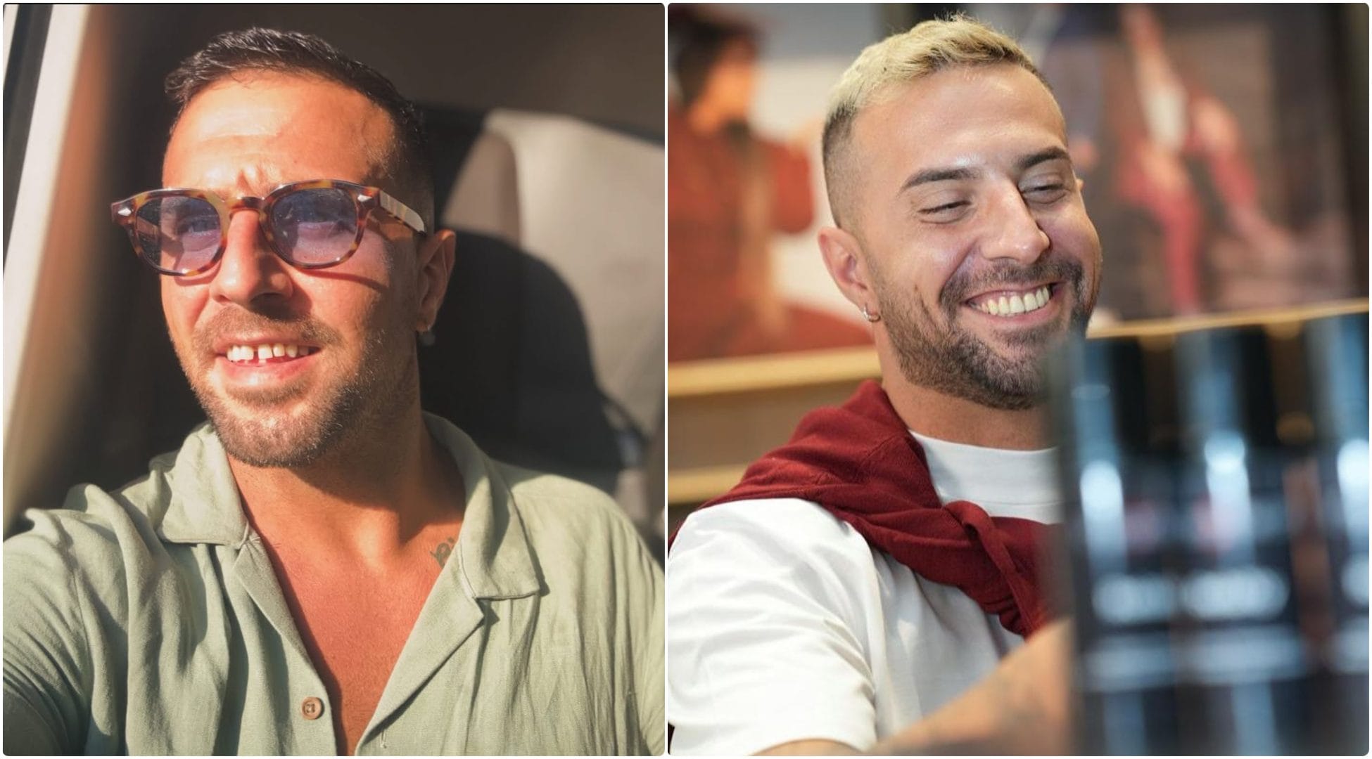 Il prima e dopo di Antonio Panico dopo Temptation Island: l’intervento estetico cui si è sottoposto